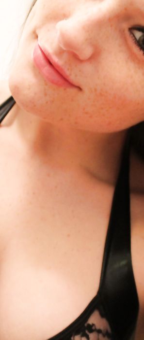 Freckles 18