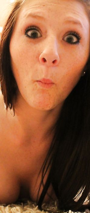 Freckles18