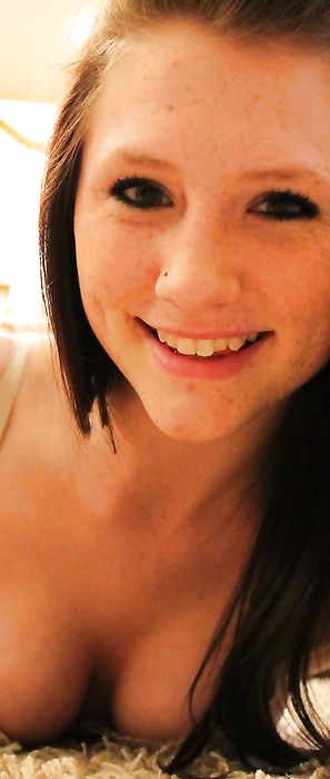 Freckles18