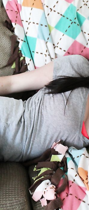 Freckles 18