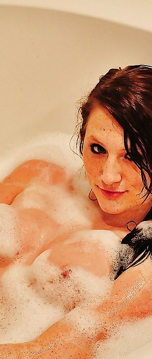 Freckles 18