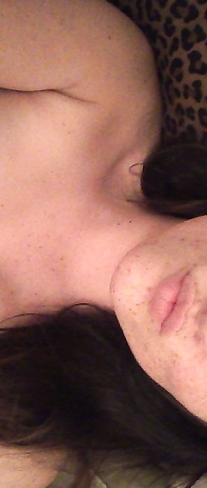 Freckles 18