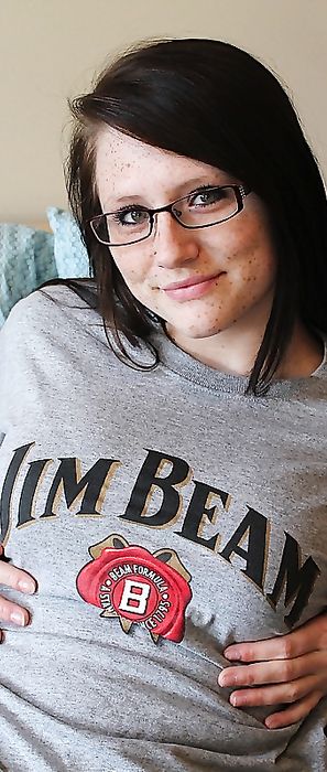 Freckles 18